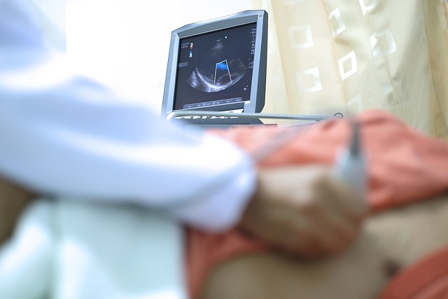 The number of echocardiograms performed in the borough fell by 76% across April and May