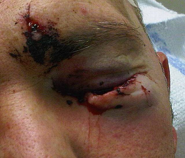 Brutal: Dave Reynolds was severely beaten on his lunch break