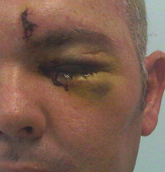 Brutal: Dave Reynolds was severely beaten on his lunch break