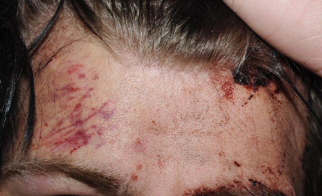 One of the victim's injuries