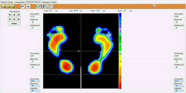 Pressure Plate Analysis