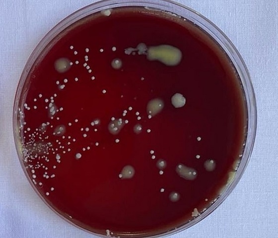 A cough plate with no mask, a typical number of bacteria colonies