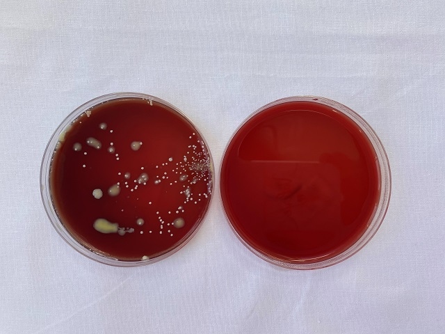 A cough plate from wearing a mask used by healthcare workers (right) vs no mask (left)