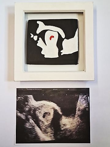 'Oh Baby!' and the scan of Penelope that would inspire it