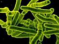 Mycobacterium Tuberculosis