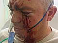 Brutal: Dave Reynolds was severely beaten on his lunch break