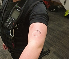 A bite injury suffered by a police officer in Rochdale last month