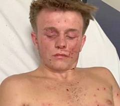 Rio Diveney, from Oldham, was injured by a firework